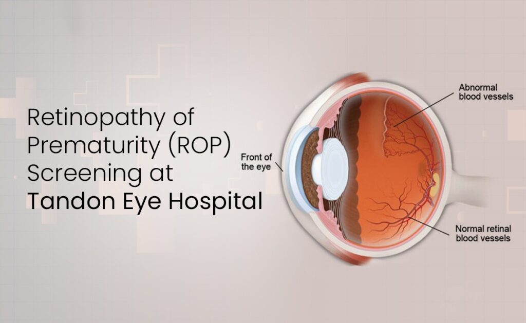 Retinopathy of Prematurity (ROP) Screening