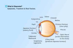 Glaucoma treatment
