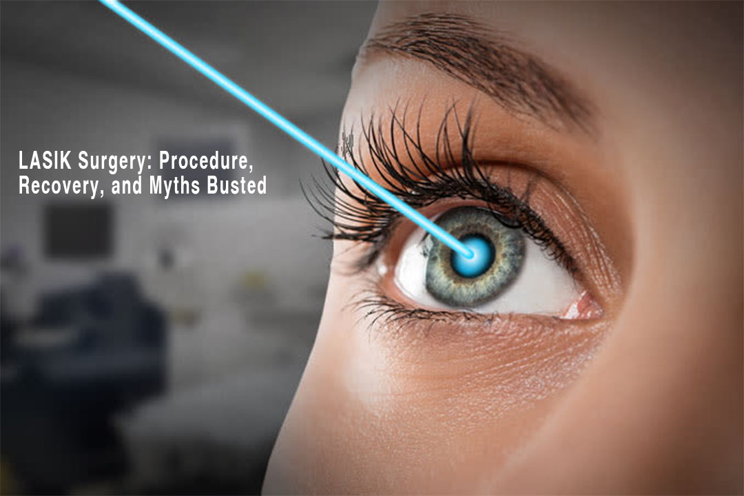 LASIK eye surgery