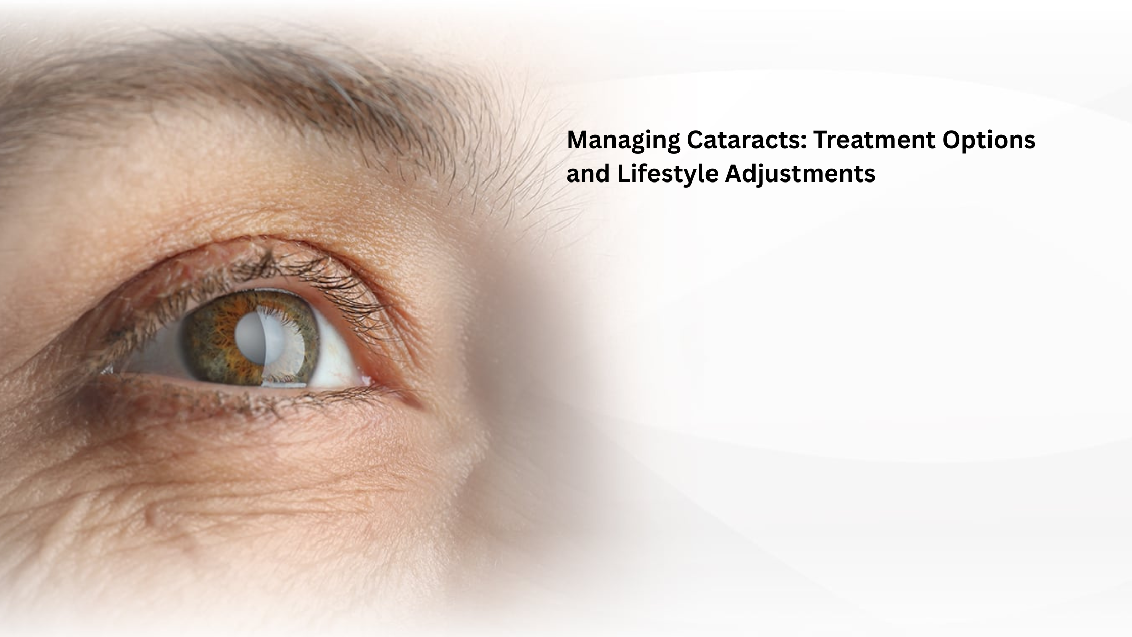 Cataracts