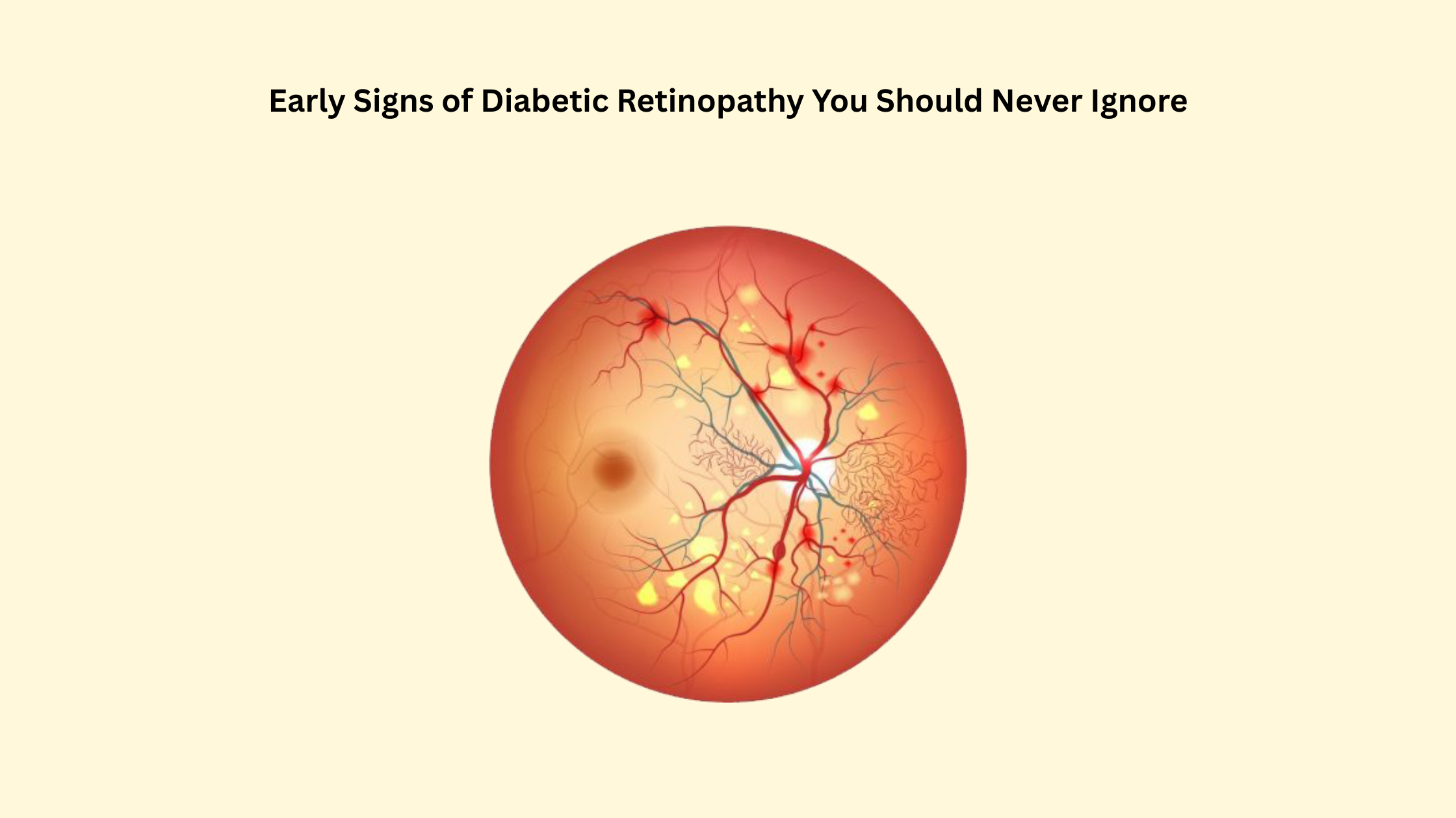 Diabetic Retinopathy