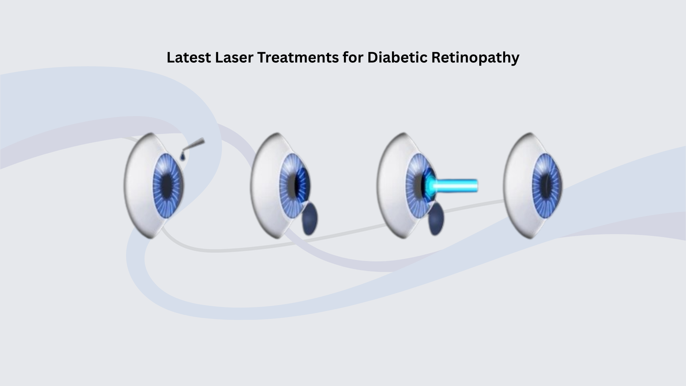 Laser Treatment