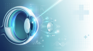 LASIK VS PRL VS ICL